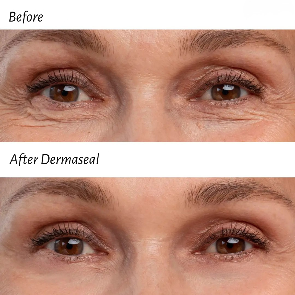 DermaSeal™  Forehead Patch
