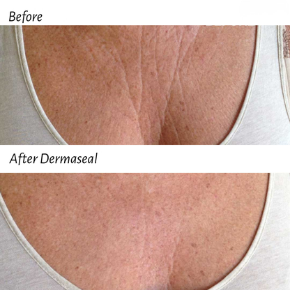 DermaSeal™  Forehead Patch